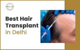 Best Hair Transplant In India | DMC Trichology, New Delhi