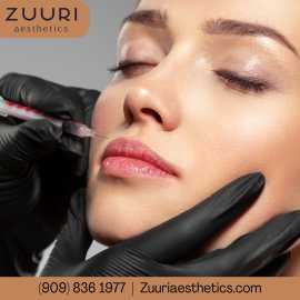Botox Rancho Cucamonga | ZUURI Aesthetics, Rancho Cucamonga