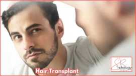 Hair Transplant In Gurgaon, Gurgaon