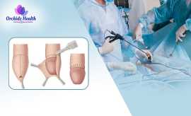Transparent Circumcision Surgery Cost in Bangalore, Bengaluru