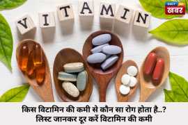 Vitamin Deficiency: Diseases and Solutions, Ahmedabad