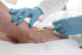 Best varicose vein treatment In New Jersey | Advan, Jersey City