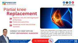 Best Knee Replacement Surgeon in Lucknow, Lucknow