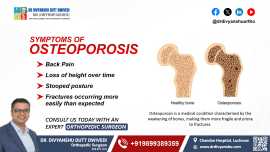 Symptoms of Osteoporosis - Dr Divyanshu , Lucknow