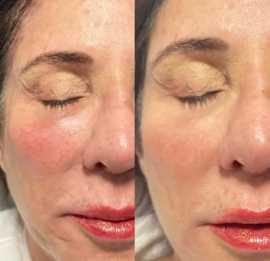 Medical Spa Orlando: Your Destination for Skin , Winter Park