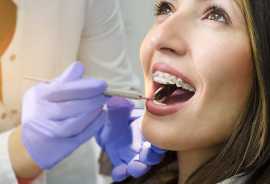 Best dentist in Fort Worth, TX, Fort Worth