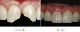 Cosmetic Dentist Sydney to Transform Your Smile, Sydney