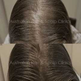Achieve Silky, Smooth Hair with Brisbane’s Best Tr, Brisbane