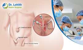Best Hernia Surgery in Bangalore - Dr. Lohith U, Bengaluru