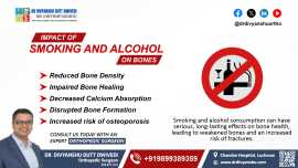 Impact of Smoking and Alcohol on Bones , Lucknow