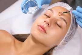ratamiento de peeling químico: clave para una piel, Barcelona
