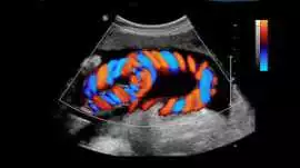 Best Color Doppler in South Delhi , New Delhi