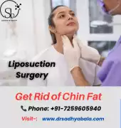 How Liposuction Surgery Helps You Get Rid of Chin?, Hyderabad