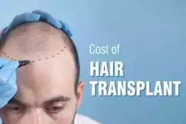 Affordable Hair Transplant Costs in India: A Compl, Mumbai