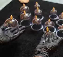 Hijama Therapy In Dubai – Natural Healing & De, Dubai