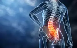  Sciatica Relief: Key Questions & Natural Solu, Auburn