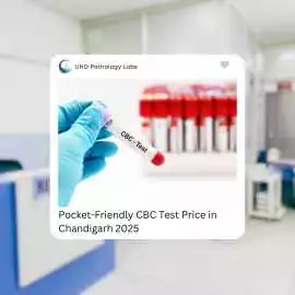 Pocket-Friendly CBC Test Price in Chandigarh 2025, Chandigarh