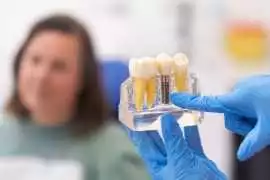 Advanced Dental Implant Treatment in Paschim Vihar, New Delhi