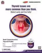 How to manage thyroid issues with diet and lifesty, Lucknow