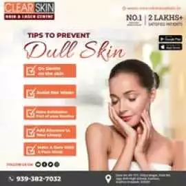 Best Birthmark removal laser treatment in india, Kurnool