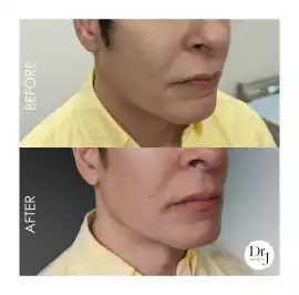 Dr J. Aesthetics - anti wrinkle treatments near me, Canberra
