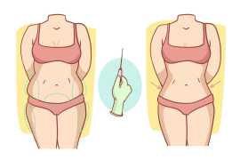 San Francisco Body Lift Procedure, San Francisco