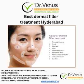 Best dermal filler treatment Hyderabad, Hyderabad