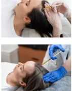 Revitalize Your Radiance: PRP Treatment in Kolkata, Kolkata