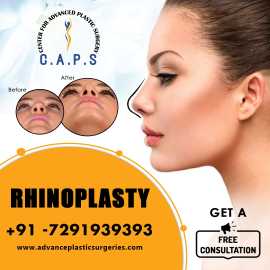 Rhinoplasty Surgery in Delhi, New Delhi