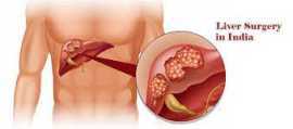 Liver Transplant Cost in India, Gurgaon