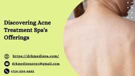 Discovering Acne Treatment Spa's Offerings, California City