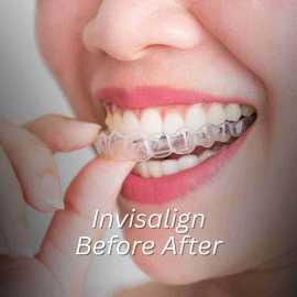 Dr. Negar - Best Dentist In Dubai, Dubai