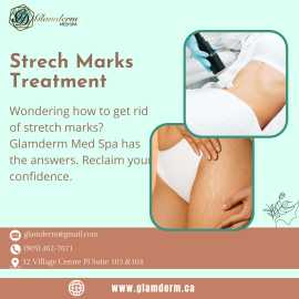 Strech Marks Treatment Services Near, Mississauga