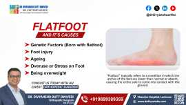 Flatfoot and Its Causes , Lucknow