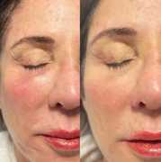Top Medical Spa Orlando: Rejuvenate Your Skin , Winter Park