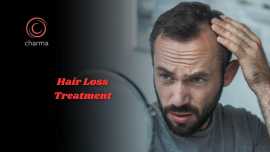 Hair Loss Treatment in Bangalore, Bengaluru