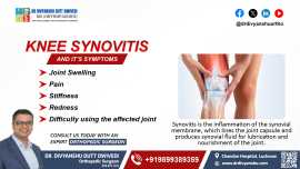 Knee Synovitis and Its Symptoms, Lucknow