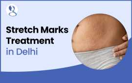 Stretch Marks Treatment In Delhi | Mehektagul, Hauz Khas