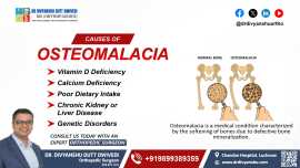 Causes of Osteomalacia: Key Risk Factors, Lucknow