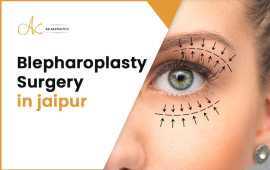 Blepharoplasty Surgery in Jaipur | Dr Akangsha, Jaipur