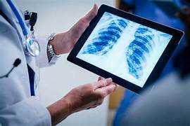 Discover the Leading X-Ray Hospital Near you : SRM, Mumbai