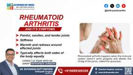 Rheumatoid Arthritis And Its Symptoms:, Lucknow