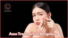 Acne Treatment in Bangalore , Bengaluru