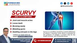 Scurvy and Its Symptoms, Lucknow