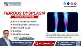 Fibrous Dysplasia: Symptoms You Shouldn’t Ignore , Lucknow