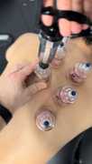 Marcel Jacobs PT: Expert Pain Relief Through Physi, New York