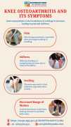Knee Osteoarthritis and Its Symptoms, Lucknow