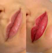Effortless Beauty with Permanent Lip Makeup, Dallas