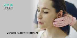 Vampire Facelift Treatment In Bangalore, Bengaluru