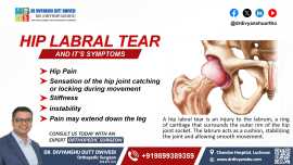 Hip Labral Tear and Its Symptoms: , Lucknow